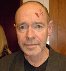 Så vill stjärnorna stoppa mobbing av personer med epilepsi