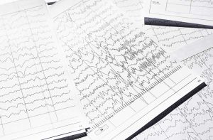 Inte nattsvart – inom egenvård finns vinnare på stärkt rätt till assistans